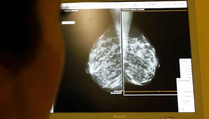 A doctor examines mammograms in Nice, south eastern France, January 4, 2008. — Reuters