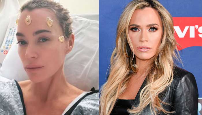 Teddi Mellencamp shares update on brain surgery: Fight is not over