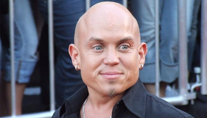 Martin Klebba claims Disney fears backlash over ‘Snow White: Source